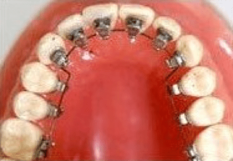 Types & Treatment Time Types & Treatment Time