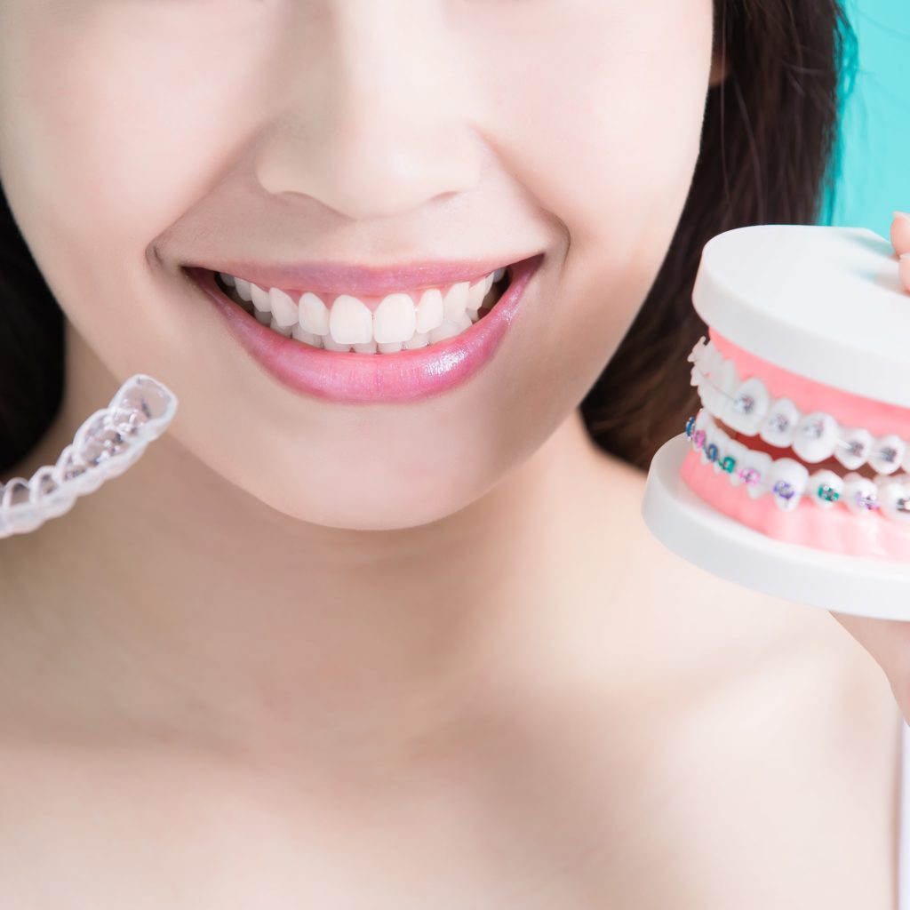 Teeth Night Guard - What You Should Know Before Getting Teeth Night Guard